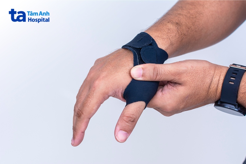 Phương pháp điều trị ngón tay cái bị cứng