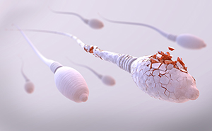 Phương pháp điều trị với trường hợp tinh trùng có phân mảnh DNA, giúp kiểm tra về tính toàn vẹn của cấu trúc di truyền