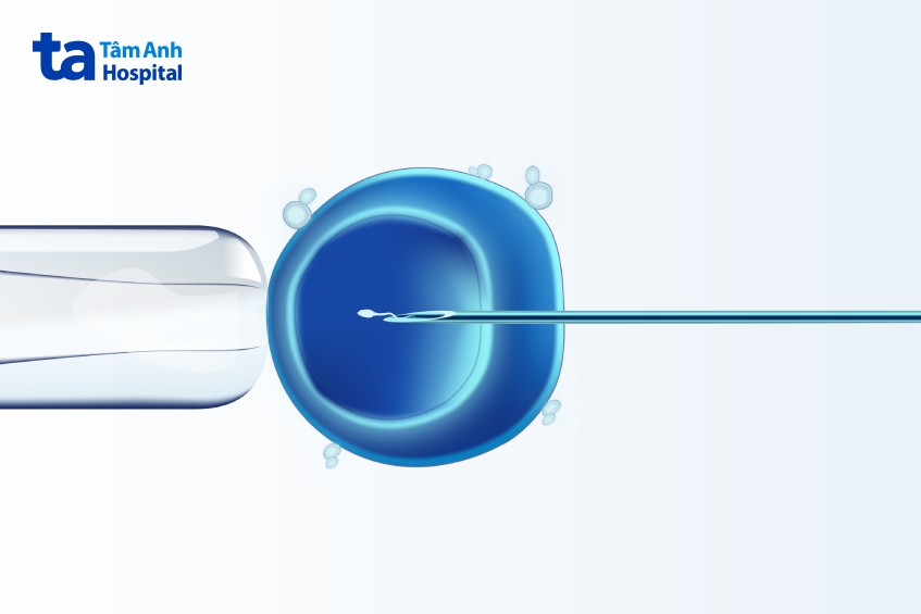 phương pháp thụ tinh ống nghiệm