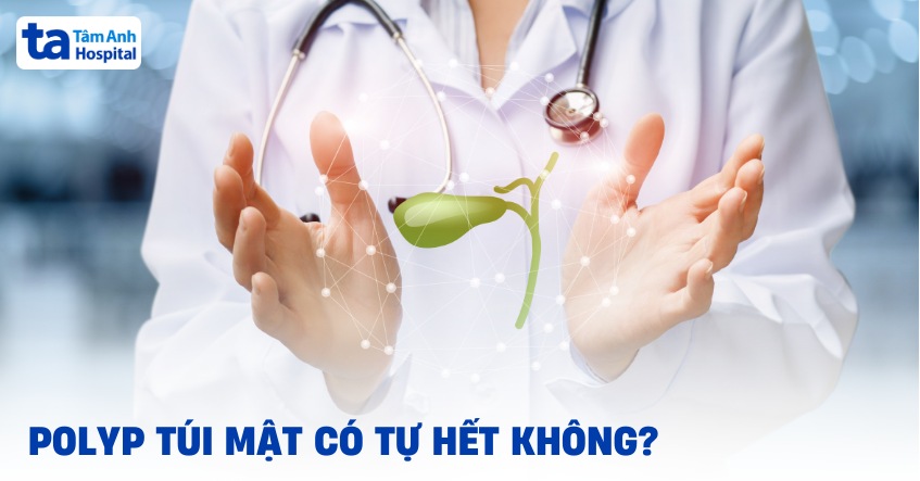 Polyp túi mật có tự hết không? Có khả năng tự biến mất?