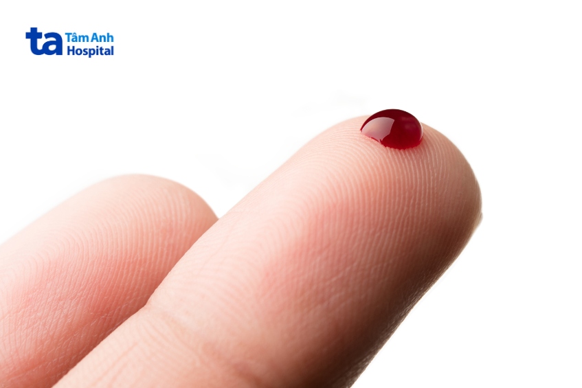 quan niệm sai khi châm kim ngón tay sơ cứu đột quỵ