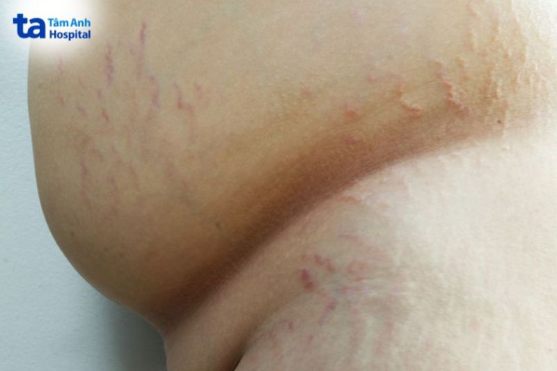 ảnh rạn da đỏ
