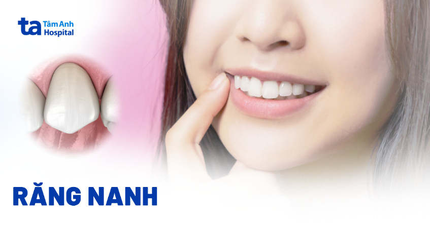 Răng nanh răng số mấy? Đặc điểm và chức năng đặc thù