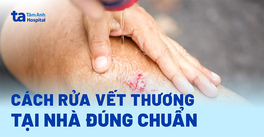 Hướng dẫn cách rửa vết thương ngoài da tại nhà đúng chuẩn