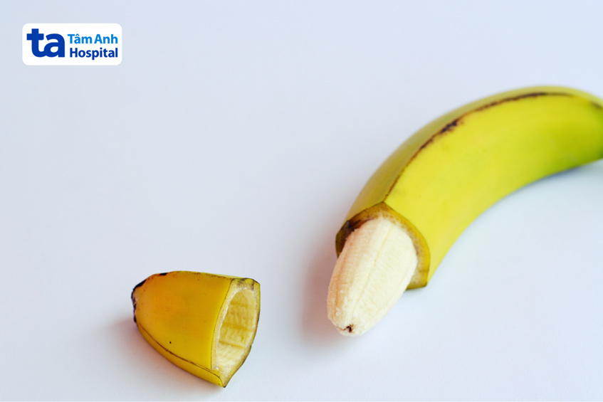 Sau cắt bao quy đầu có đi lại được không là thắc mắc của nhiều nam giới