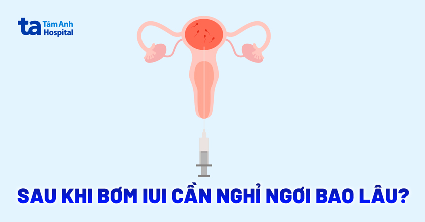 Sau khi bơm IUI cần nghỉ ngơi bao lâu? Tại sao lại quan trọng?