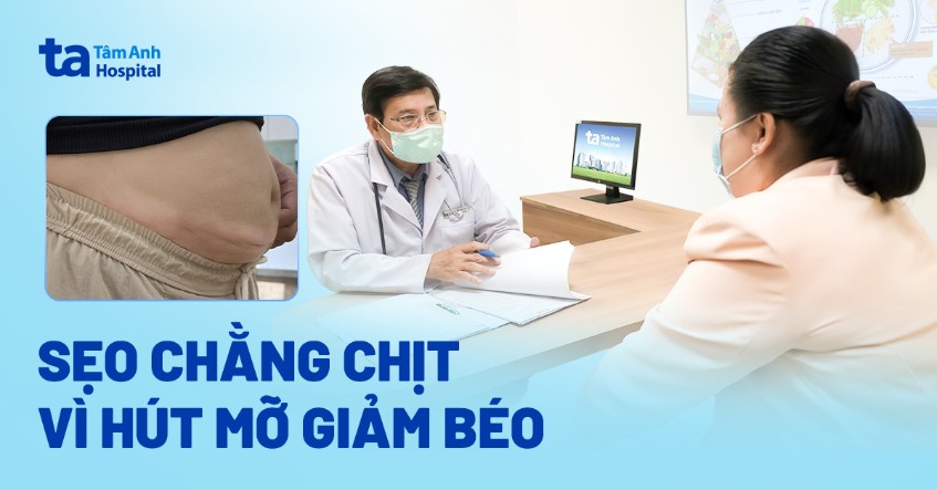 sẹo chằng chịt vì hút mỡ giảm béo