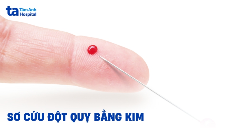 Sơ cứu đột quỵ bằng kim có nên không? Quan niệm sai lầm cần lưu ý