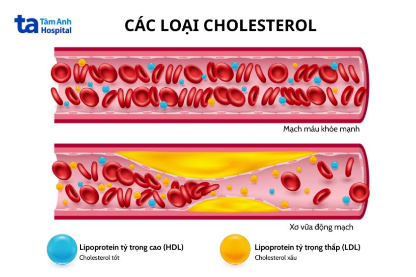 So sánh lipoprotein tỷ trọng cao (HDL) và lipoprotein tỷ trọng thấp (LDL) giữa người khỏe mạnh và người mắc bệnh.
