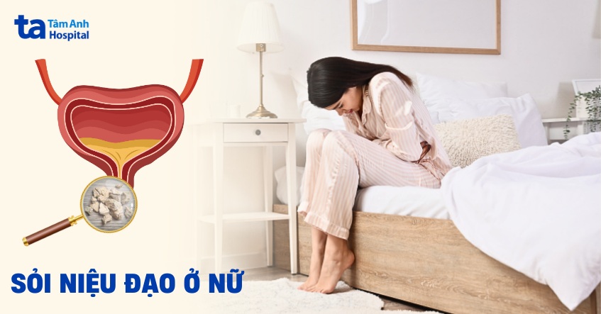 Sỏi niệu đạo ở nữ: Nguyên nhân, triệu chứng, điều trị, phòng ngừa