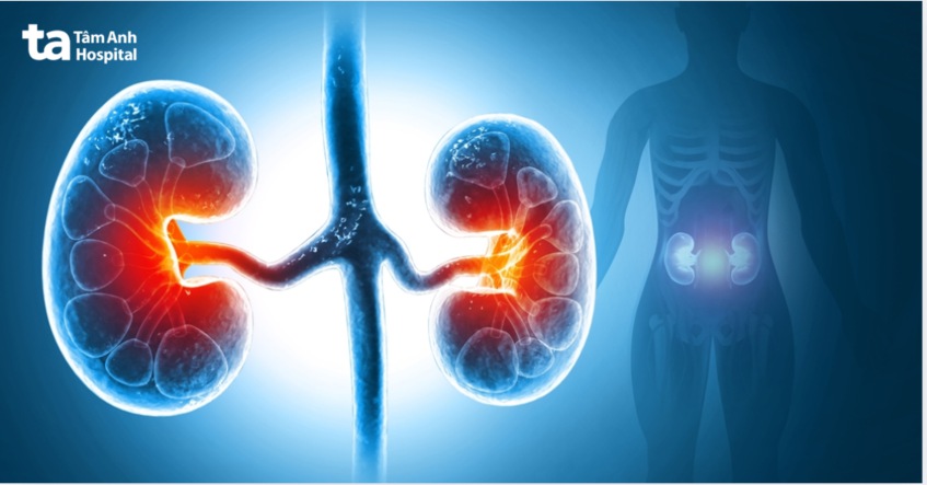 sự khác nhau giữa suy thận và thận ứ nước