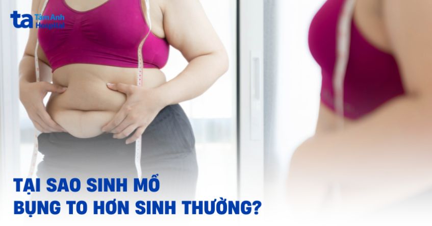 Tại sao sinh mổ bụng to hơn sinh thường