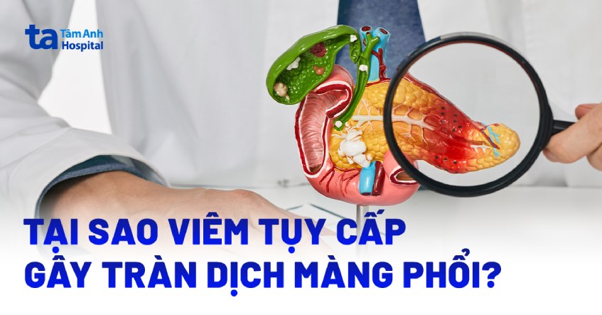 Tại sao viêm tụy cấp gây tràn dịch màng phổi? [Bác sĩ tư vấn]