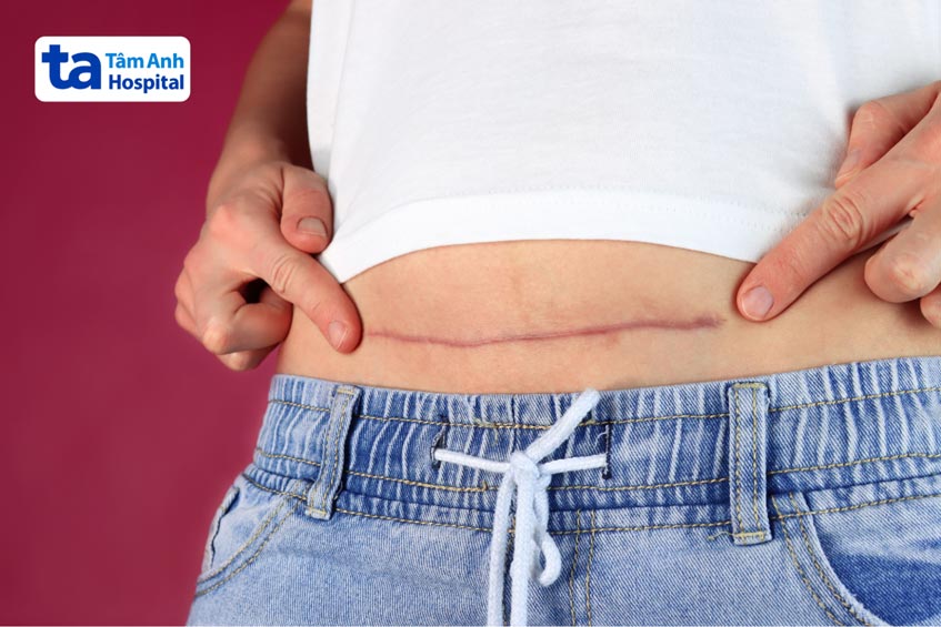 thắc mắc của nhiều chị em