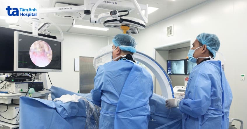 bác sĩ Cao Vĩnh Duy đang thực hiện tán sỏi