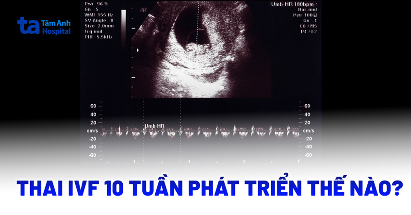 Thai IVF 10 tuần phát triển như thế nào?