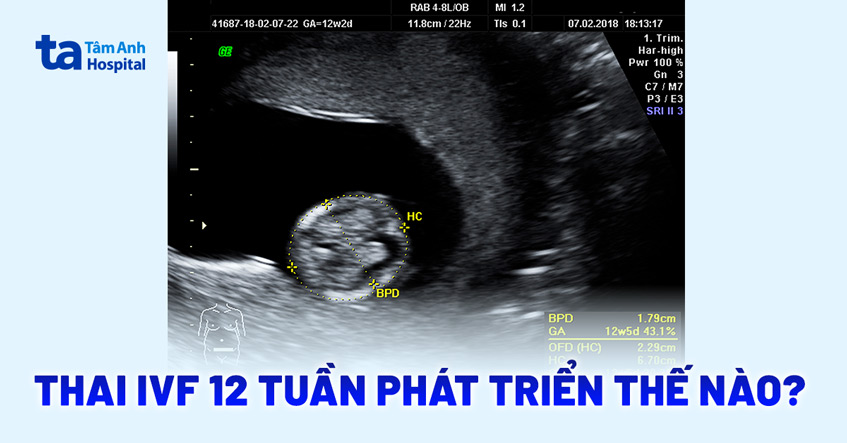 Thai IVF 12 tuần phát triển như thế nào? Đã ổn định chưa?