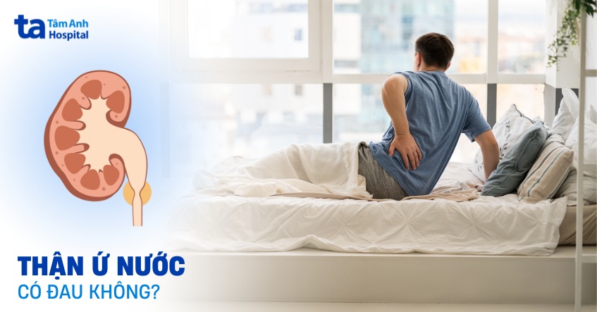 Bị thận ứ nước có đau không? Có gây đau lưng không?