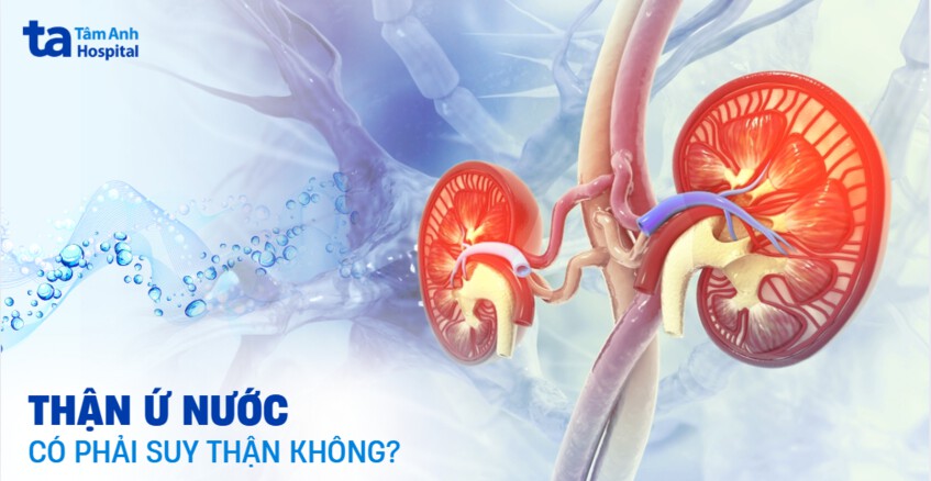 Thận ứ nước có phải suy thận không? Nguy cơ như thế nào?
