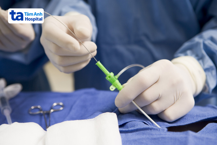 Thông tim chẩn đoán bệnh lý ở van động mạch chủ