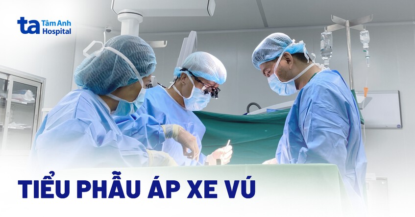 Tiểu phẫu áp xe vú: Khi nào lựa chọn? Chỉ định và chống chỉ định