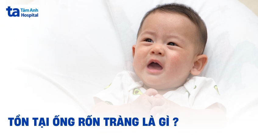 tồn tại ống rốn tràng