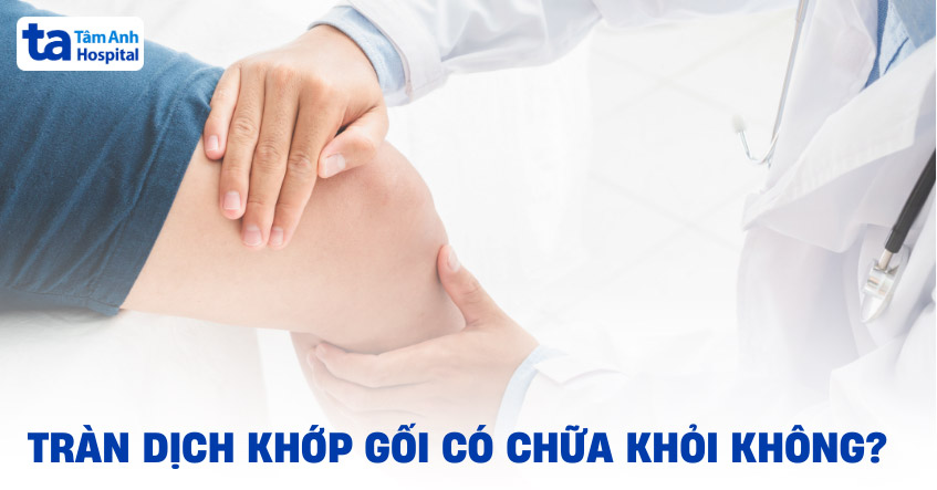 Tràn dịch khớp gối có chữa khỏi không? Yếu tố nào quyết định?
