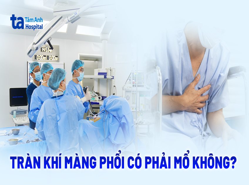 Tràn khí màng phổi có phải mổ không? Khi nào cần phẫu thuật?