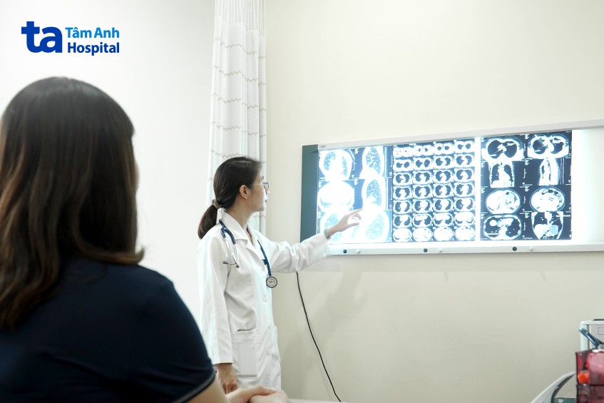 tràn khí màng phổi có thể tự khỏi