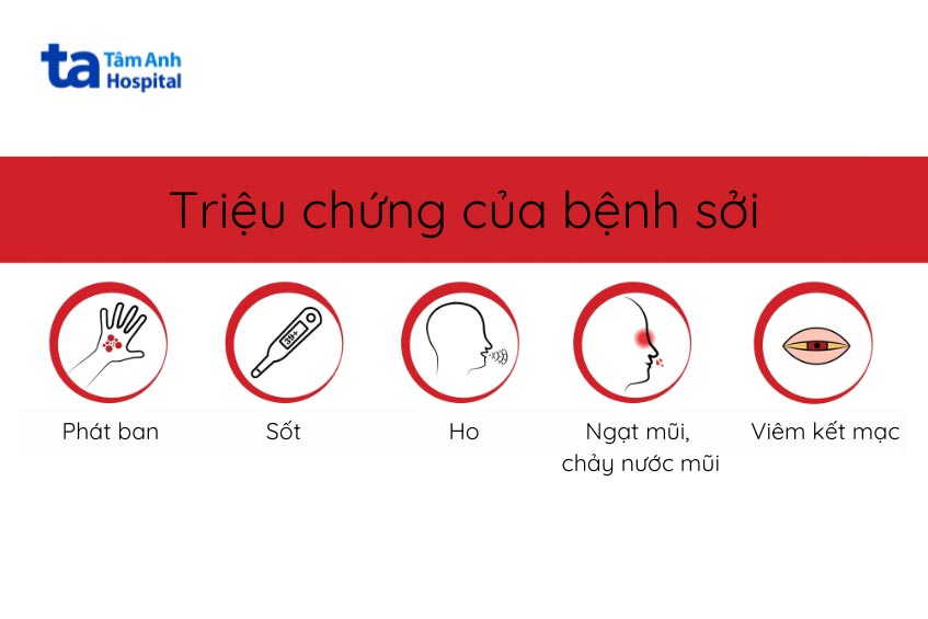 triệu chứng bị sởi khi mang thai