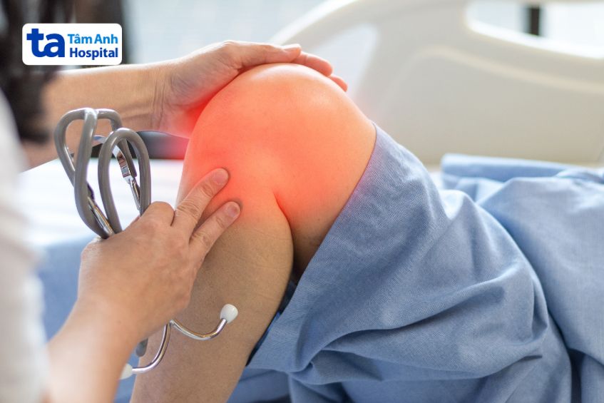 Triệu chứng của viêm màng hoạt dịch thể lông nốt
