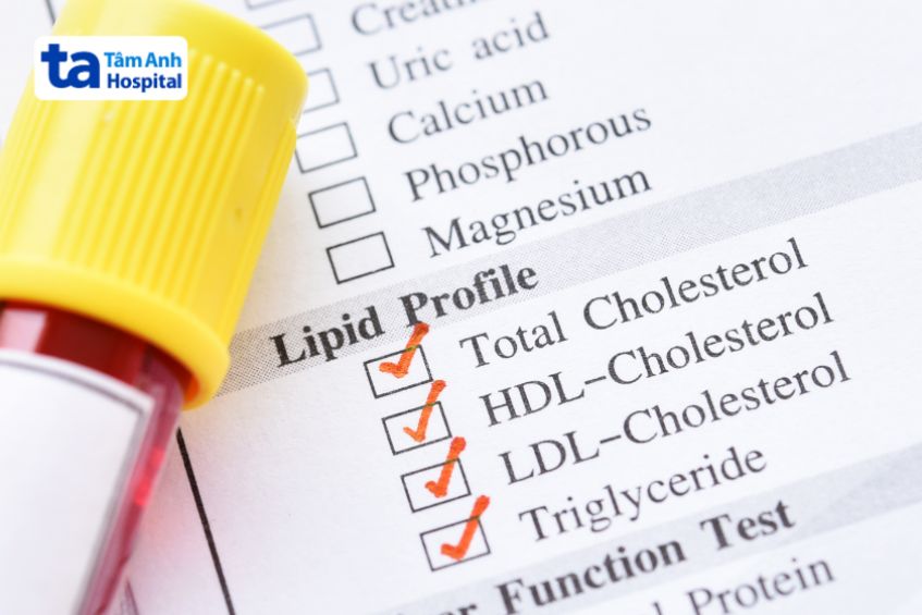 Triglyceride không phải là cholesterol. Cholesterol, triglycerid và phospholipid là 3 loại lipid chính của cơ thể.