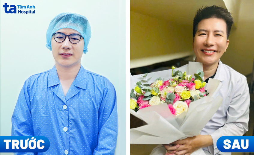 trước và sau khi bs đạt mổ cận