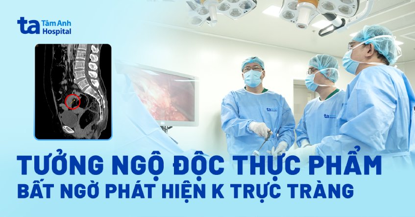 tưởng ngộ độc thực phẩm