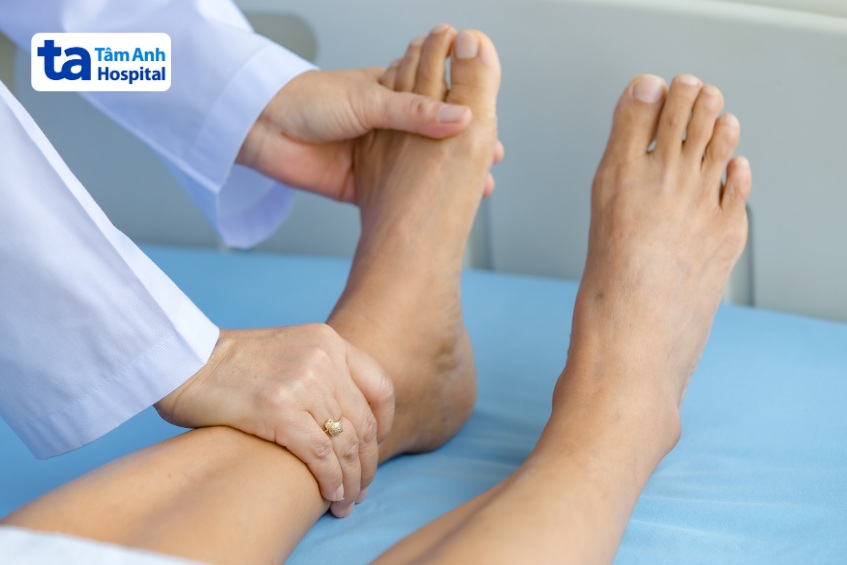 u dây thần kinh ở chân thường lành tính