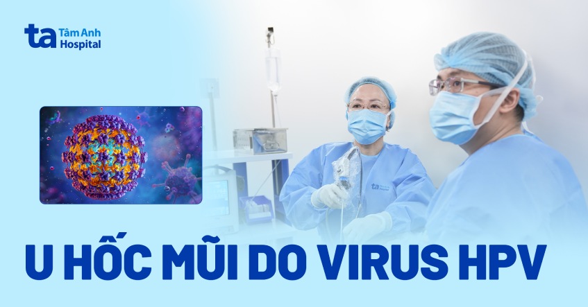 U hốc mũi do virus HPV