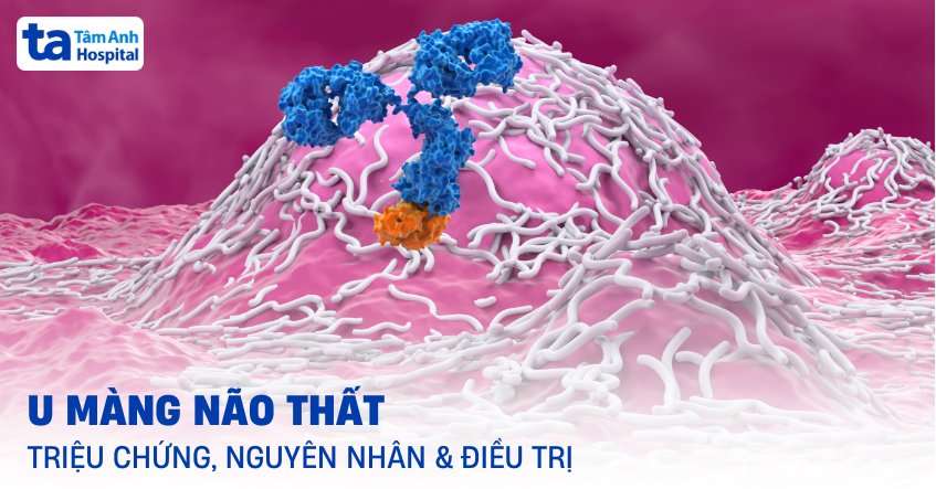 U màng não thất: Triệu chứng, nguyên nhân, chẩn đoán, điều trị