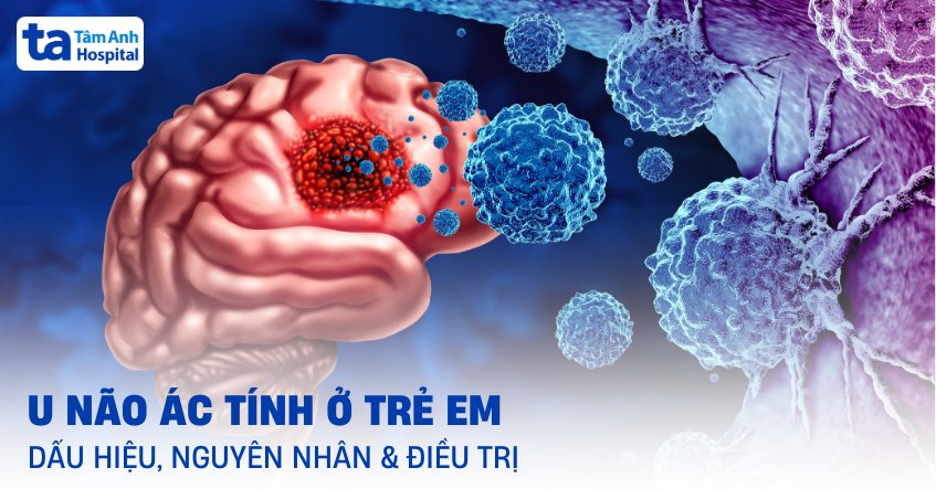 U não ác tính ở trẻ em: Dấu hiệu, nguyên nhân, chẩn đoán, điều trị