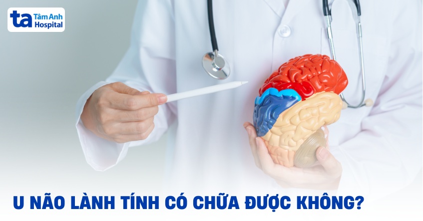 u não lành tính có chữa được không
