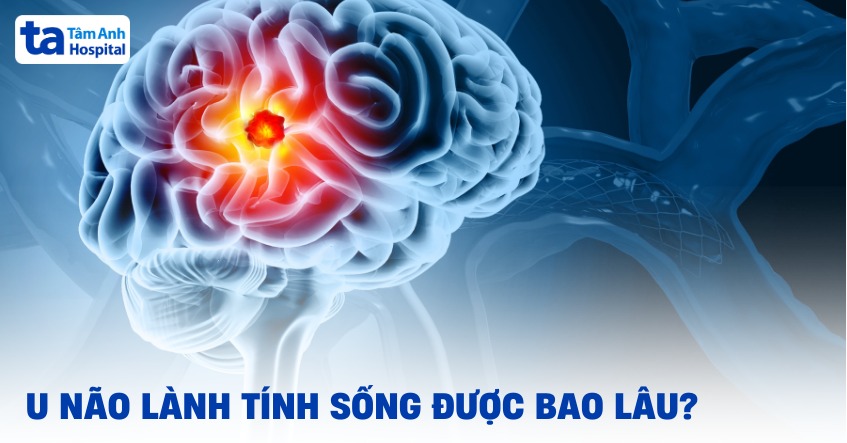 U não lành tính sống được bao lâu? Yếu tố ảnh hưởng tiên lượng