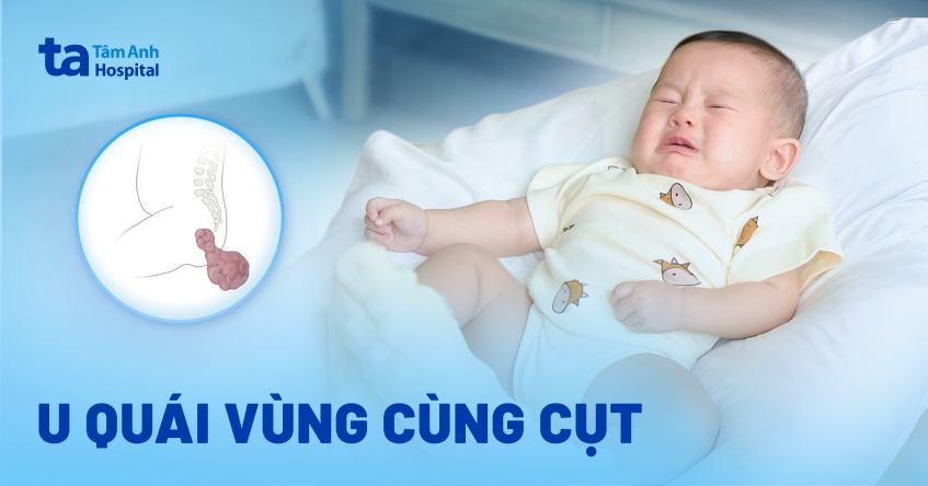 u quái vùng cùng cụt