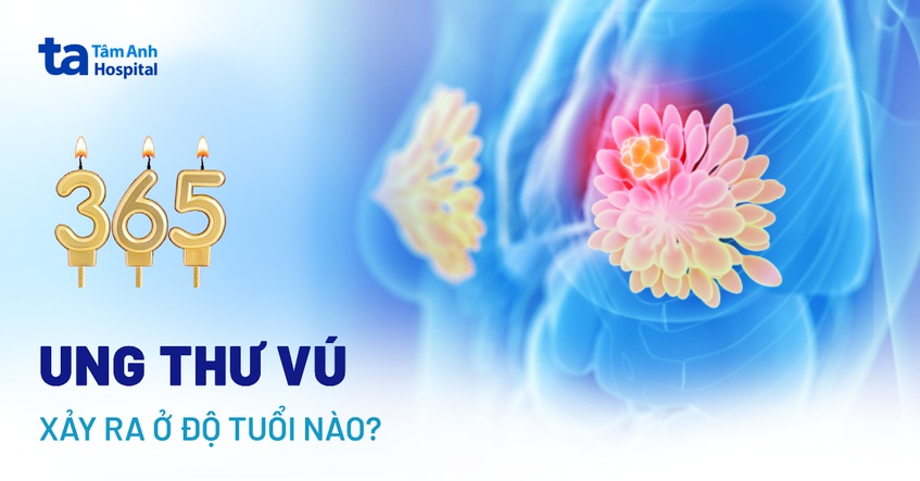 Ung thư vú xuất hiện ở độ tuổi nào? Bảng thống kê chi tiết