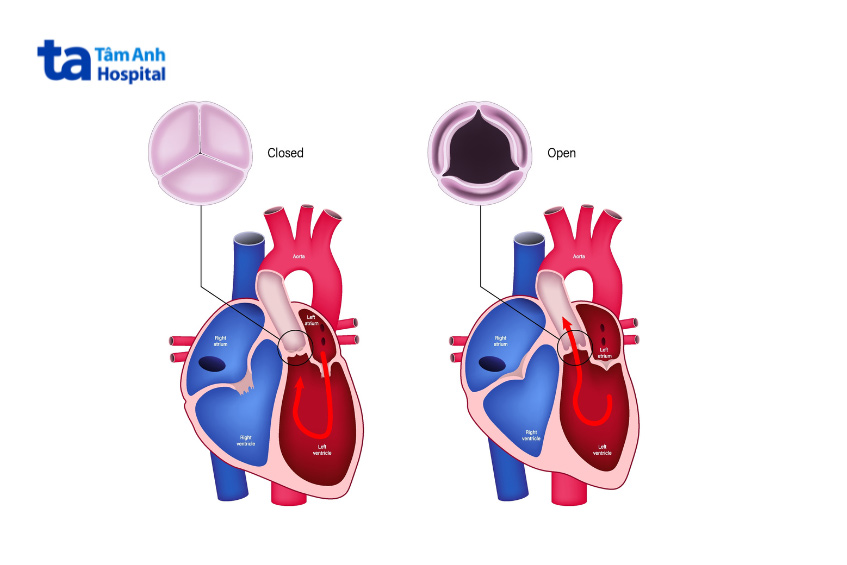 Van động mạch chủ đóng, mở nhịp nhàng theo chu kỳ co bóp của tim
