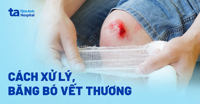 9 các loại vết thương thường gặp từ ngoài vào trong