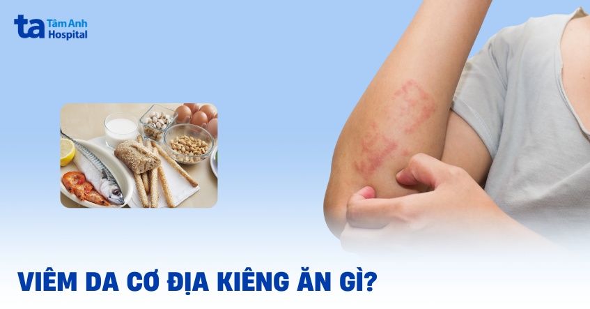 Viêm da cơ địa kiêng ăn gì? Kiêng bao lâu? Nên ăn gì cho tốt?