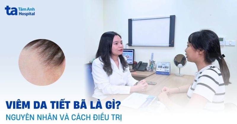 viêm da tiết bã