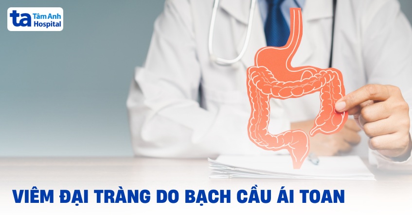 Viêm đại tràng do bạch cầu ái toan: Nguyên nhân, chẩn đoán bệnh