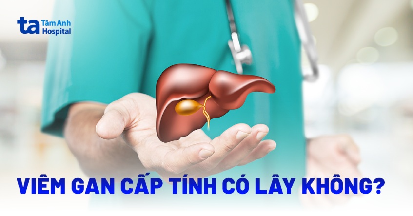 Viêm gan cấp tính có lây không? Lây qua đường nào?