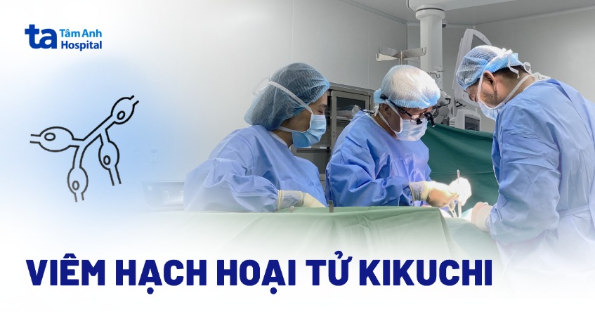 Viêm hạch hoại tử Kikuchi: Dấu hiệu, nguyên nhân và điều trị