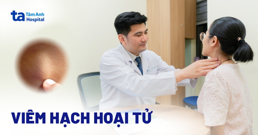 Viêm hạch hoại tử: Triệu chứng, nguyên nhân và cách chẩn đoán